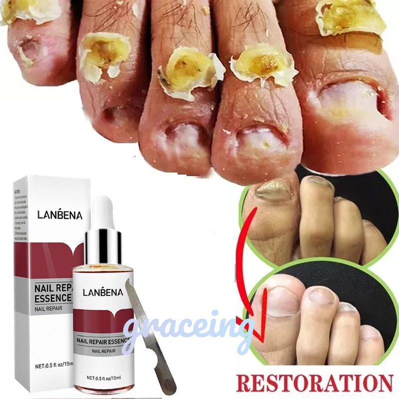 LANBENA ESCENCIA DE REPACIÓN DE UÑAS