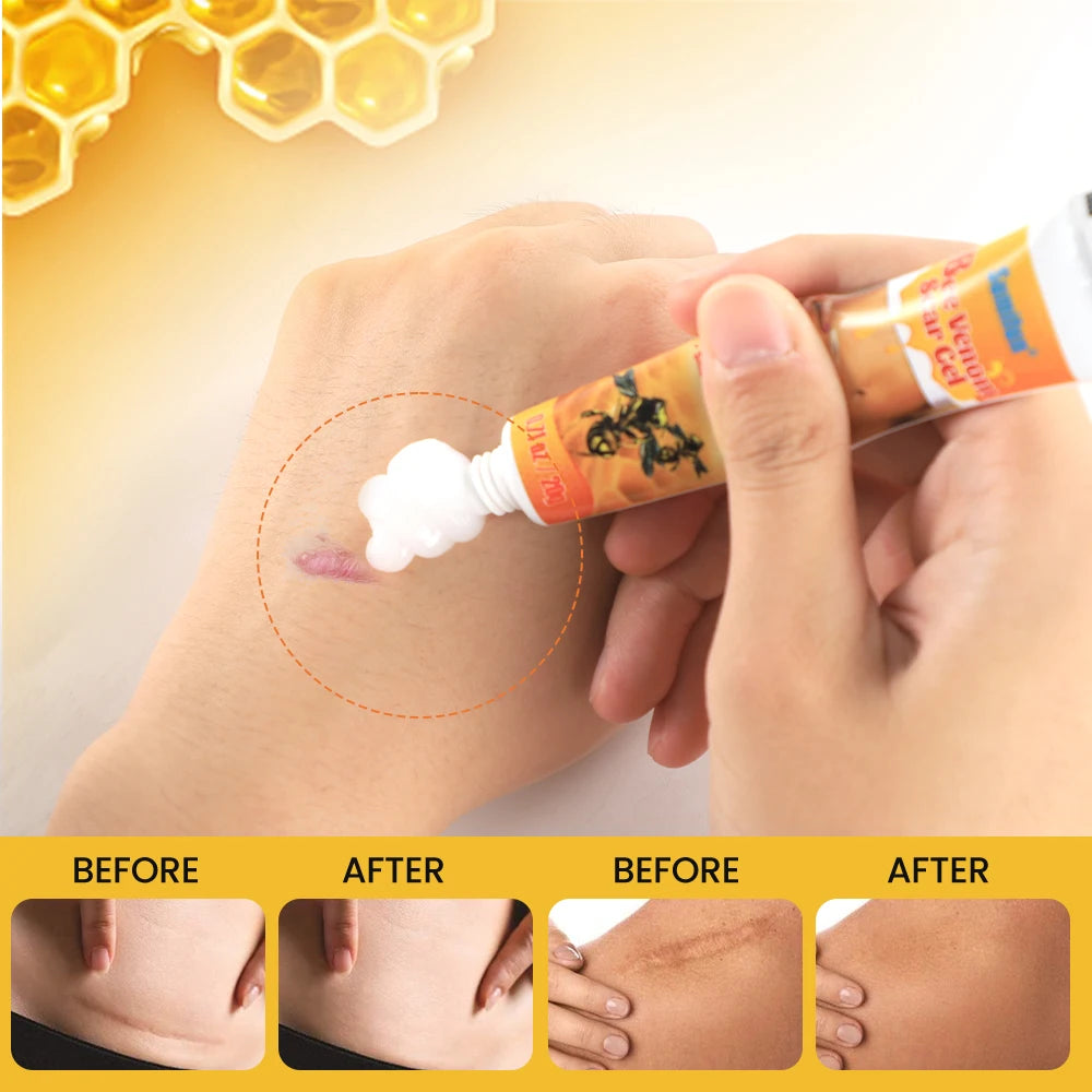 CREMA PARA ELIMINAR CICATRICES SUMIFUN