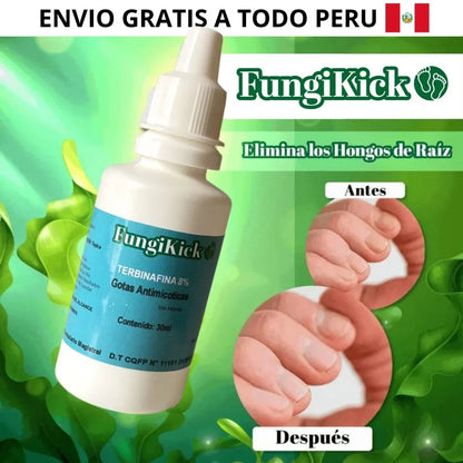 GOTAS CONTRA HONGOS DE LAS UÑAS